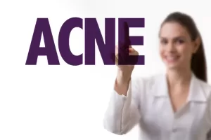 Faq acne