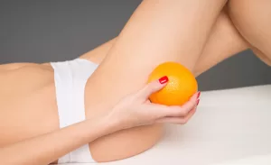 Cellulite ti odio! Consigli per sconfiggerla - VediamociChiara