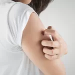 Orticaria - VediamociChiara
