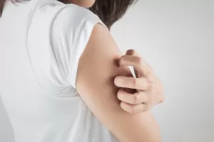 Orticaria - VediamociChiara