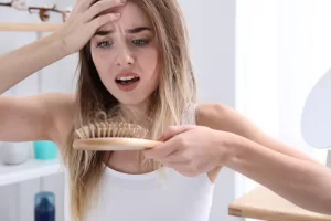 Alopecia Areata