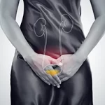 Come prevenire la cistite ricorrente